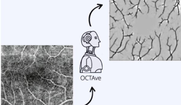 OCTAve